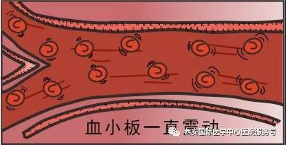 血小板是正常值的三倍？專家提醒小心血栓和出血！