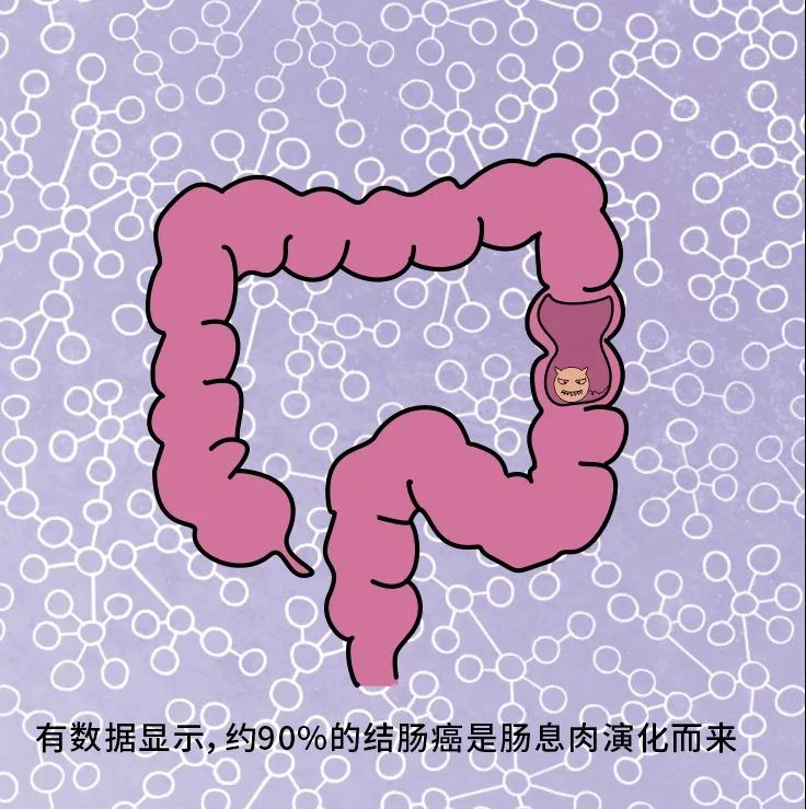 奪走“黑豹”生命的結(jié)腸癌，到底什么來頭？