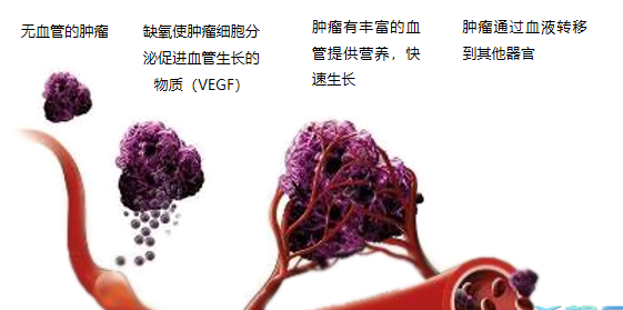 晚期腫瘤為什么會復發(fā)轉(zhuǎn)移？