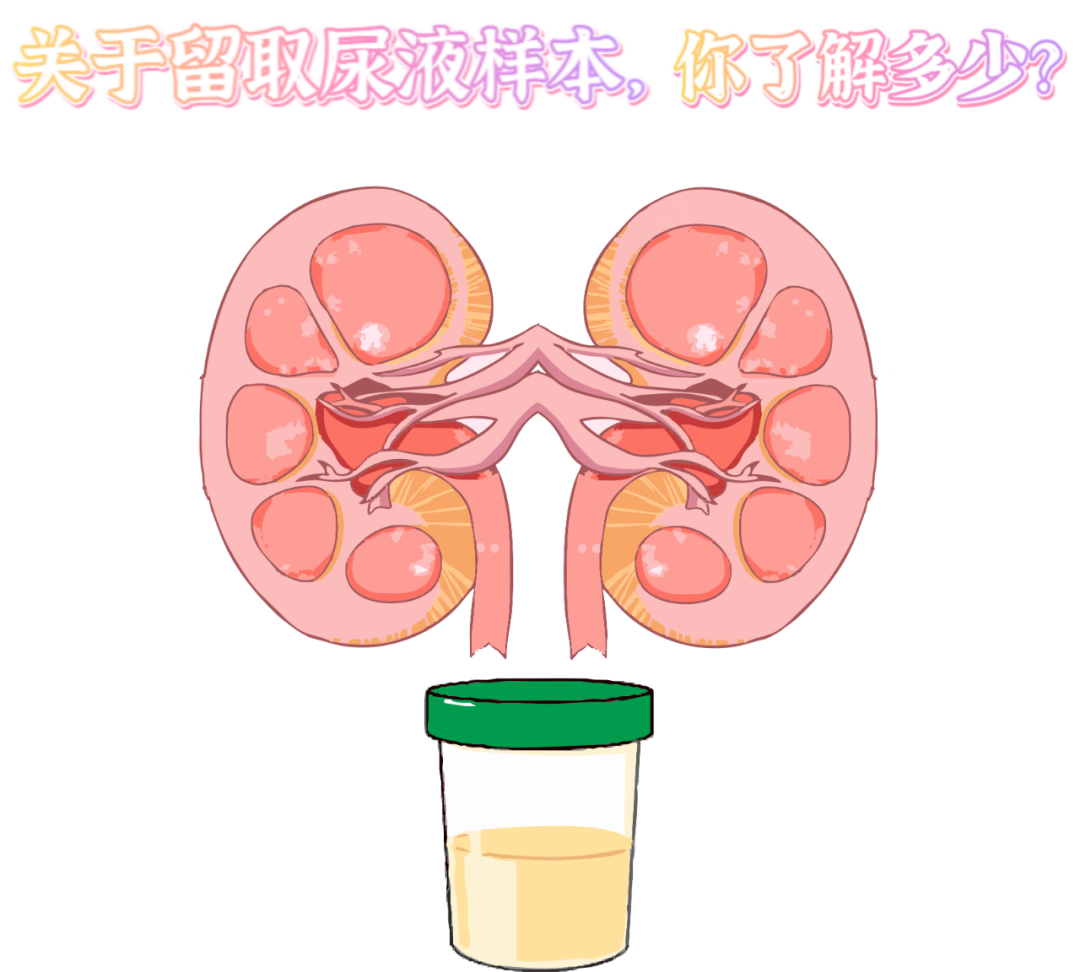 做尿檢，不得不說的注意事項(xiàng)！