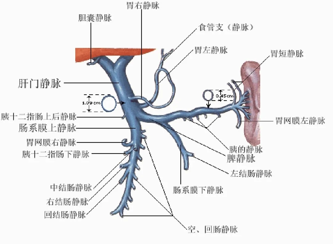 反復(fù)嘔血、黑便怎么辦？TIPS手術(shù)能解決