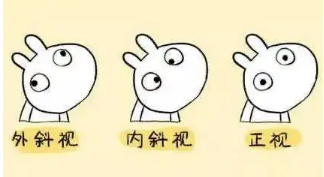 小baby老歪著頭？警惕斜頸! 這樣糾正……