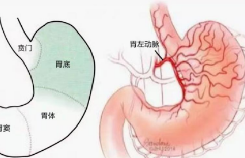 不開刀不吃藥不餓肚子，微創(chuàng)介入減肥靠譜嗎？