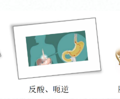 關(guān)愛身體健康，輕松檢查胃腸
