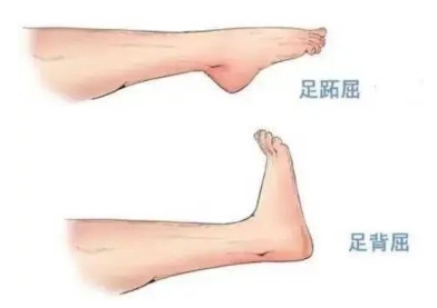 扭胯小連步、動(dòng)感搖花手……“科目三”雖火，運(yùn)動(dòng)損傷也要防！