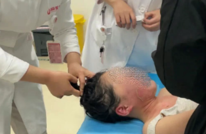 14歲，面、頸、胸燙傷，只因中午那鍋面湯…