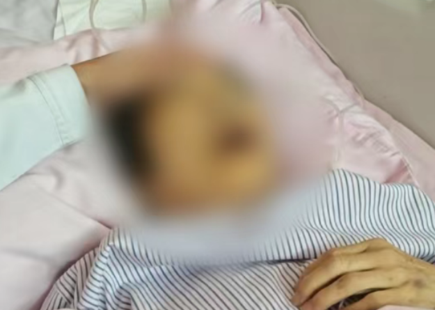 病房突發(fā)意外：老人痛苦拔管后，監(jiān)護儀瘋狂報警